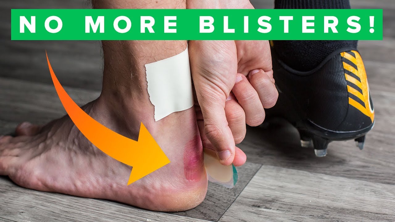 How to Fix Boots That Give You Blisters